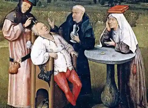 Кровопускание в средние века